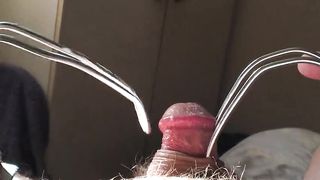 Что же скрывается под шкуркой на пенисе?