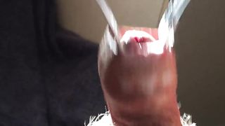 Что же скрывается под шкуркой на пенисе?